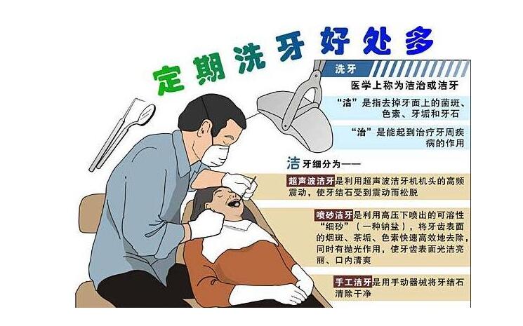 定期洗牙